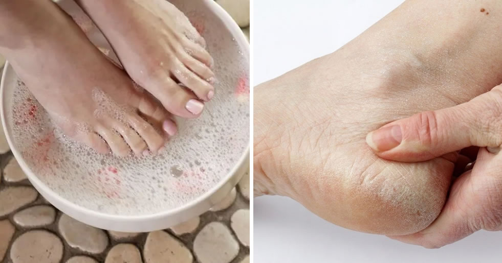 Perfekte Füße den ganzen Sommer: die unfehlbare Do-it-yourself-Methode