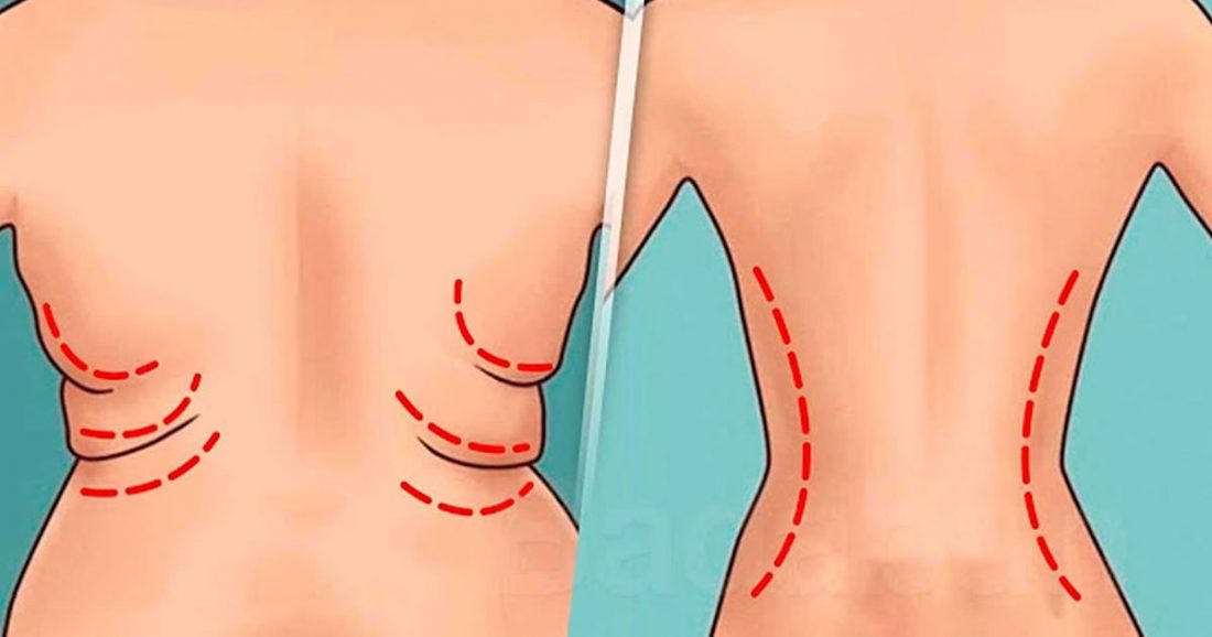 Poignées d’amour : comment s’en débarrasser en 7 jours