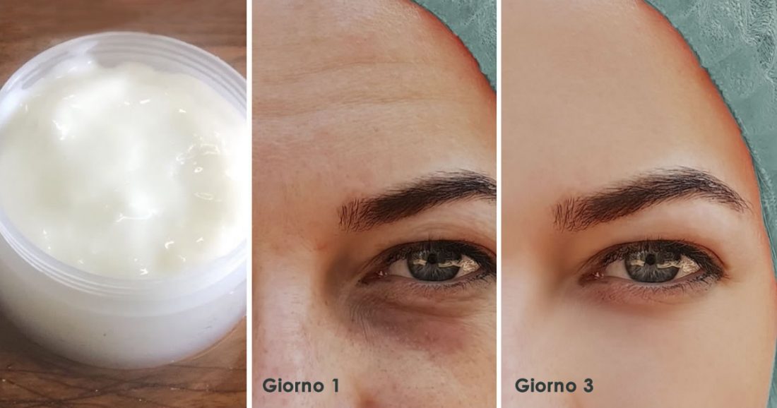 Masque au riz contre les rides et les imperfections : appliquer 3 fois par semaine pour un visage rajeuni de 10 ans