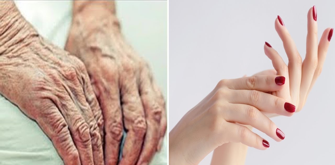 La meilleure recette pour rajeunir les mains, en éliminant les signes du vieillissement