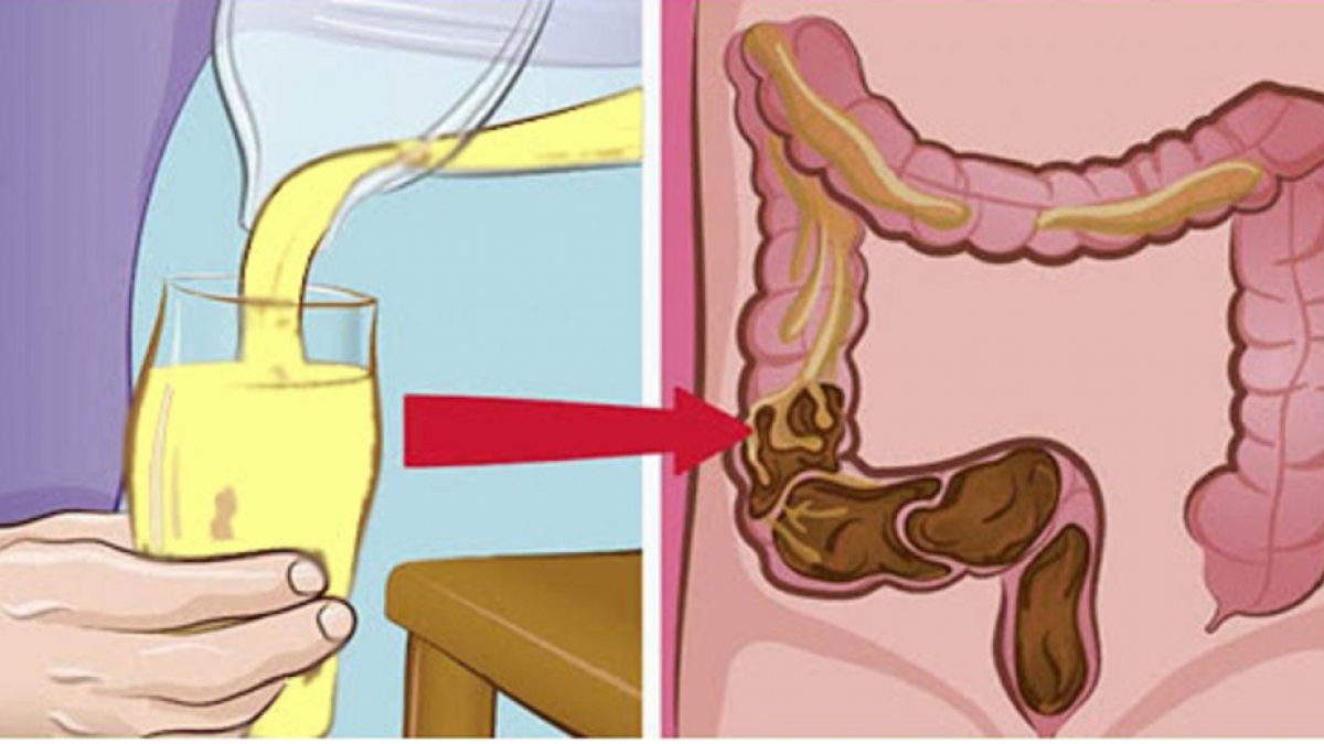 Comment préparer la boisson qui nettoie le côlon et combat la constipation
