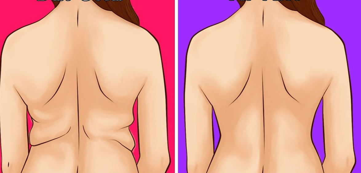 6 Übungen für einen perfekten Rücken ohne Diät