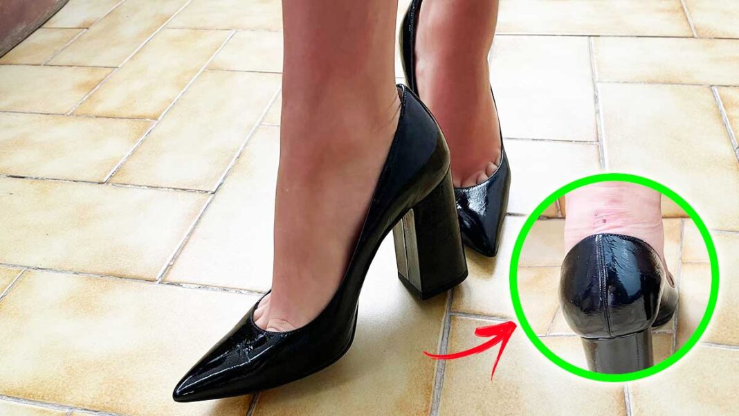 5 Tipps zur Vermeidung von Blasen an den Füßen