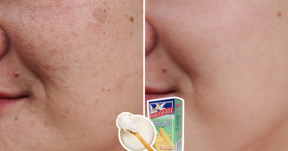 Tonifier la peau, réduire les rides et les taches brunes avec un masque maison à base d’amidon de maïs