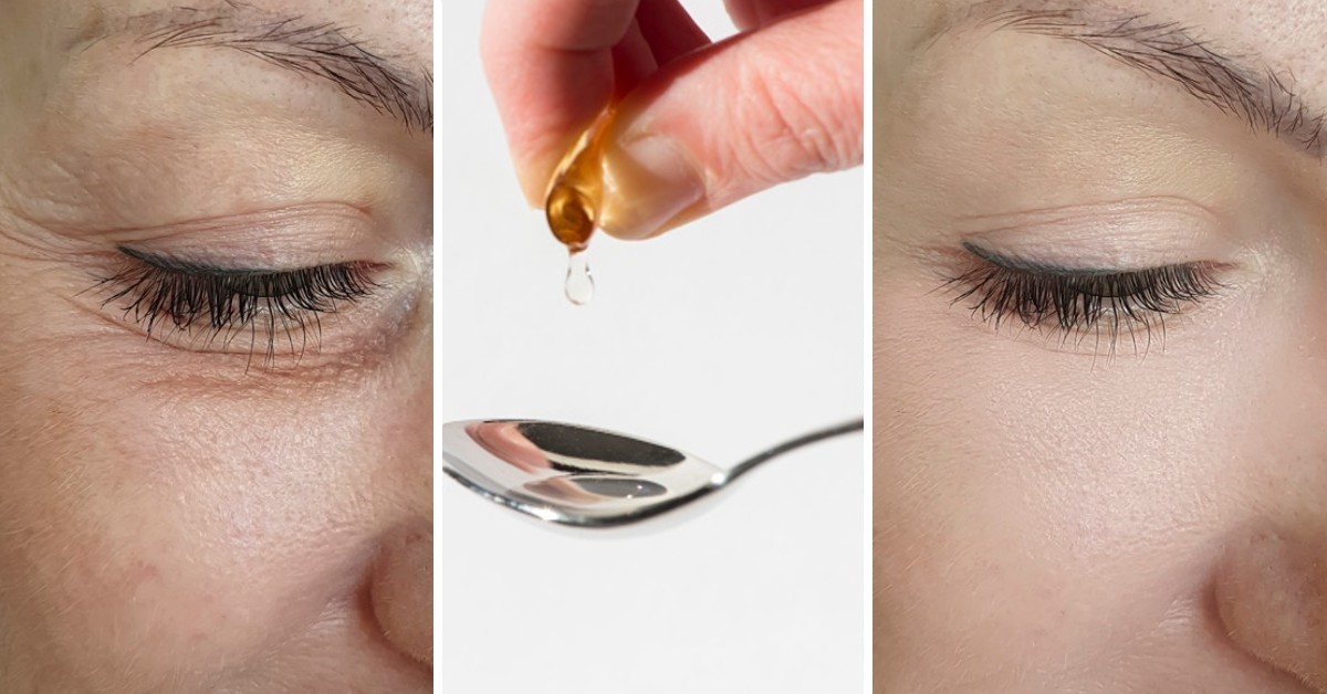 Comment utiliser la vitamine E pour rajeunir le contour des yeux