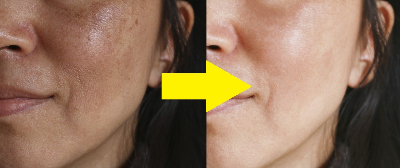 Masques hydratants pour avoir un visage lisse, prévenir les rides et éliminer les imperfections