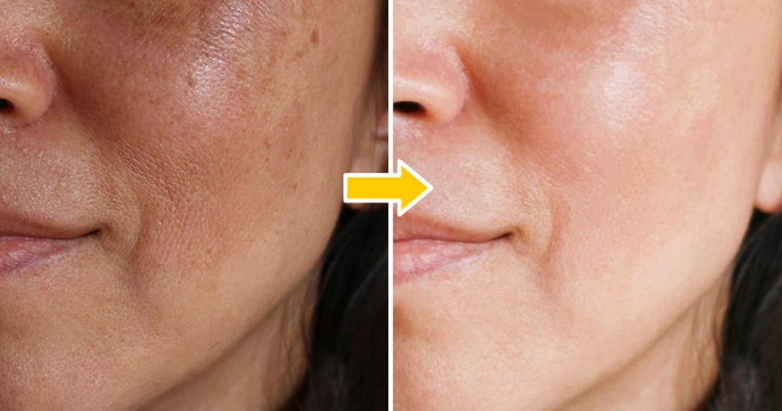 Éliminez les imperfections avec 4 masques infaillibles pour une peau douce et rajeunie