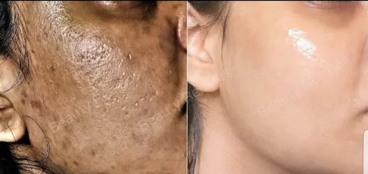 5 astuces et masques maison à base de bicarbonate de soude pour blanchir la peau