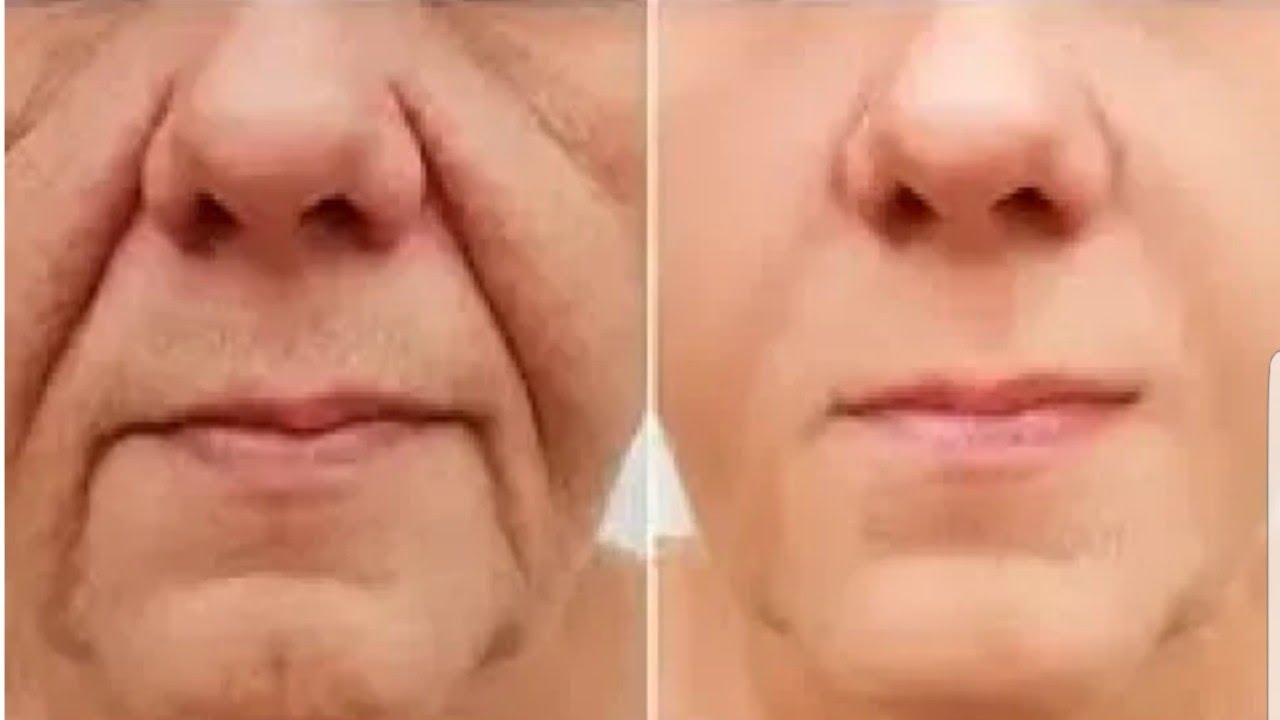 Le Masque japonais de grand-mère pour éliminer les rides d’expression autour des lèvres