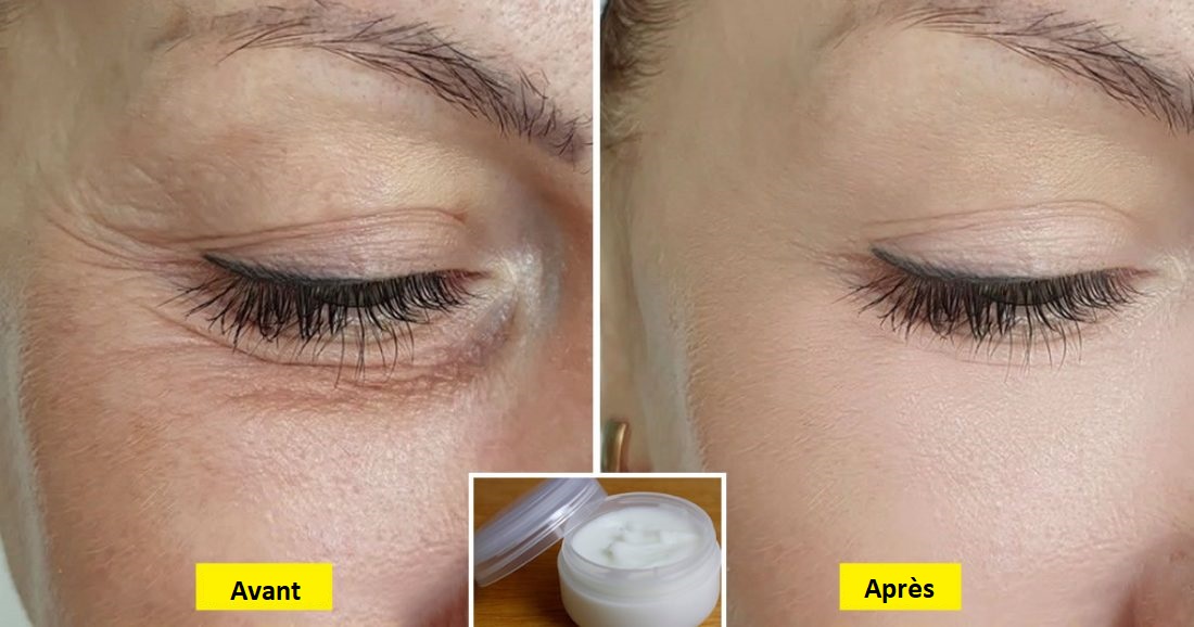 Rajeunir le contour des yeux : 6 astuces pour un regard plus jeune en quelques minutes