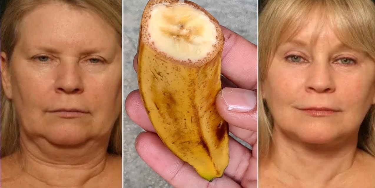 Eine Gesichtsmaske mit Banane zur Reduzierung von Falten und als Alternative zu BOTOX